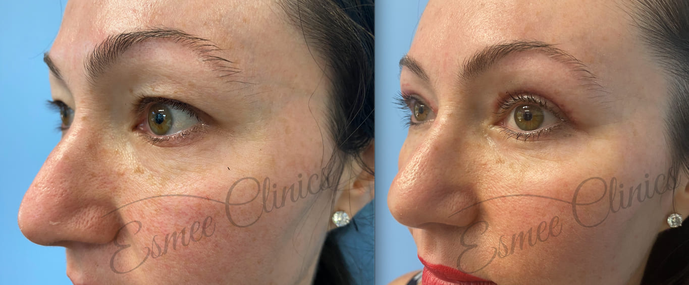 Before and After img